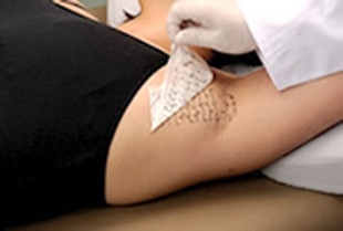 2.治療部位のマーキングシート