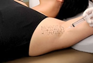 3.注射による麻酔